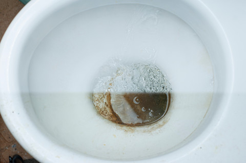 brown stains in toilet02