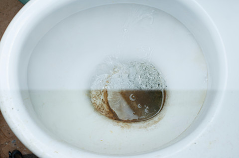 brown stains in toilet02